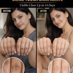 How to Naturally Brighten Dark Knuckles Fast