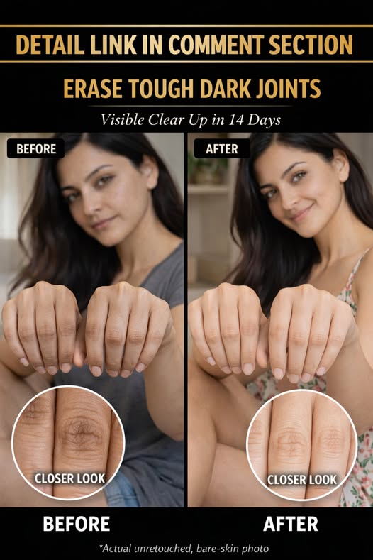 How to Naturally Brighten Dark Knuckles Fast