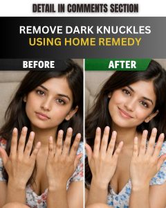 Natural Ways to Brighten Dark Knuckles Safely