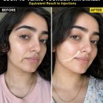 Natural Face Lifting Remedies for Youthful Skin