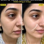 Natural Face Lifting Remedies for Youthful Skin Fast