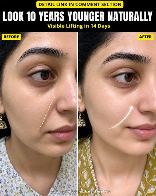 Natural Face Lifting Remedies for Youthful Skin Fast
