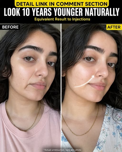 Natural Face Lifting Remedies for Youthful Skin