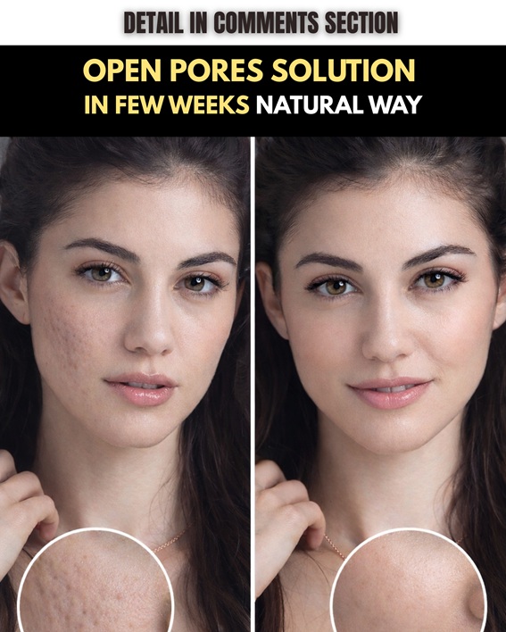 Natural Ways to Minimize Open Facial Pores Fast