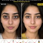 Natural Ways to Plump Under-Eye Hollows Fast