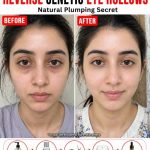Natural Ways to Reduce Under Eye Hollows