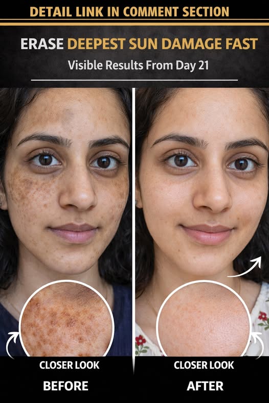Remove Deep Sun Damage Naturally and Safely