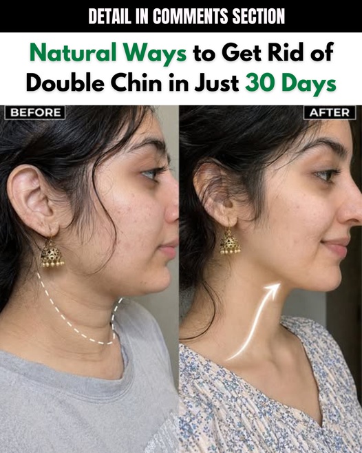 Natural Ways to Get Rid of Double Chin in Just 30 Days
