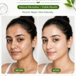 Glass Skin Transformation Naturally at Home