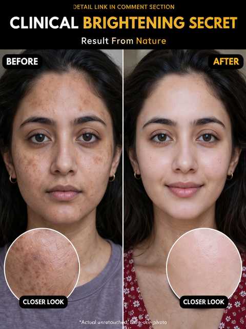 Shrink Enlarged Pores Naturally in Two Weeks