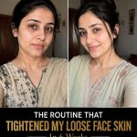Tighten Loose Face Skin Naturally in 6 Weeks Using Proven Home Remedies
