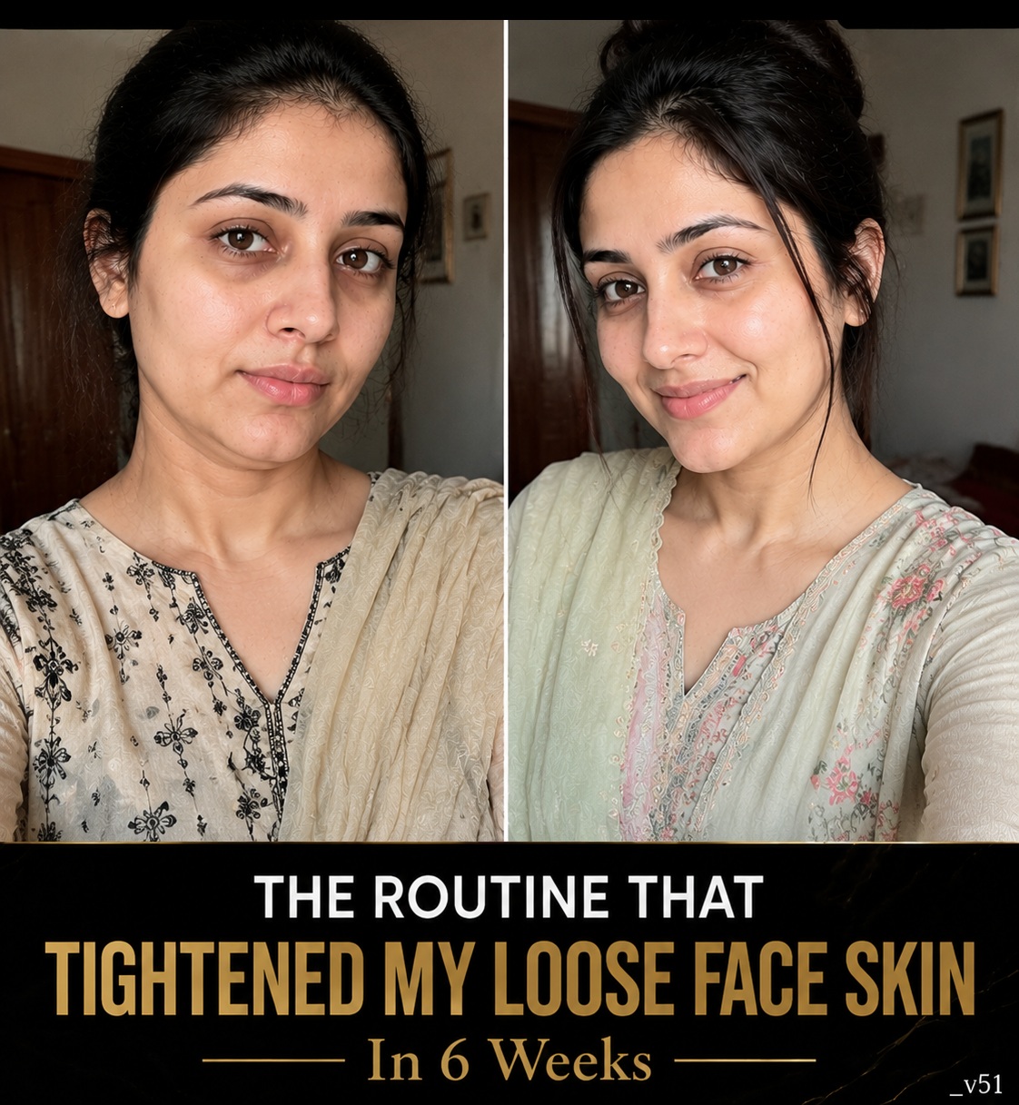 Tighten Loose Face Skin Naturally in 6 Weeks Using Proven Home Remedies