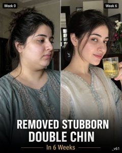 3 Age-Wise Natural Approaches for Reducing the Appearance of a Double Chin