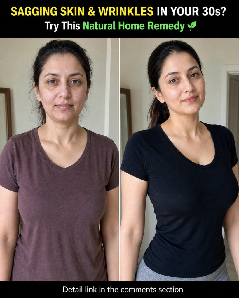 Sagging Skin and Wrinkles in Your 30s: Natural Home Remedies by Skin Type