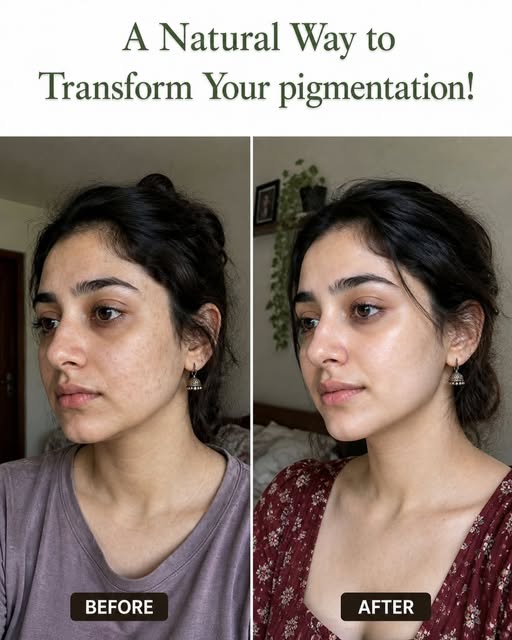 https://vbeautify.com/2026/05/05/a-natural-way-to-transform-pigmentation-skin-type-based-home-remedies-and-diet-plan/