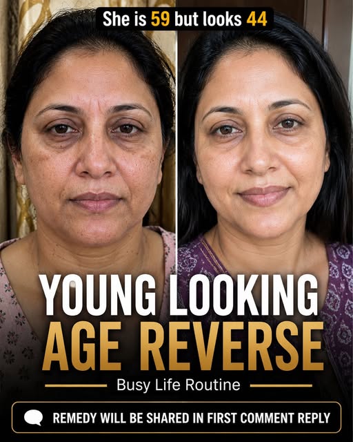 Young Looking Age Reverse: Natural Busy-Life Skin Tightening Remedies by Skin Type