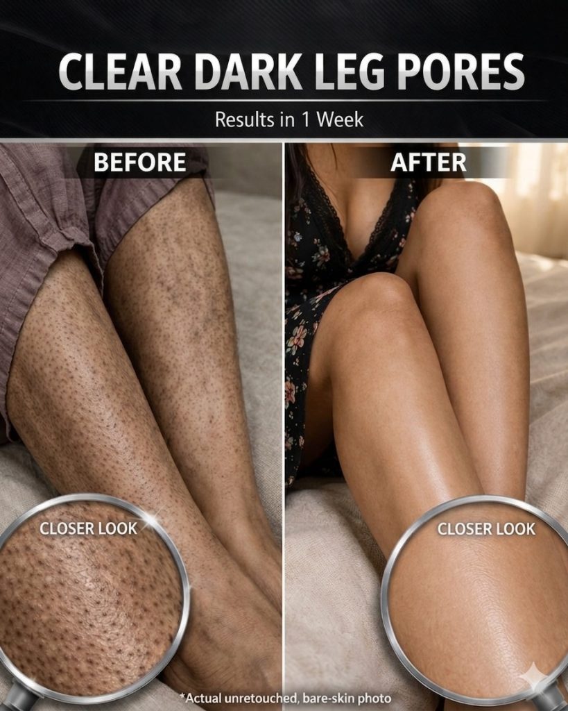 Clear Dark Leg Pores Naturally in 1 Week – Proven Home Remedies for Every Skin Type