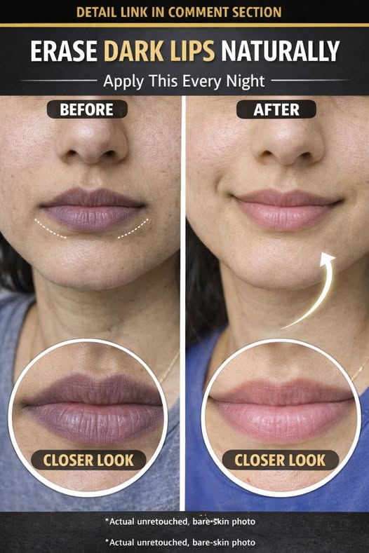 Erase Dark Lips Naturally with Scientifically Supported Home Remedies