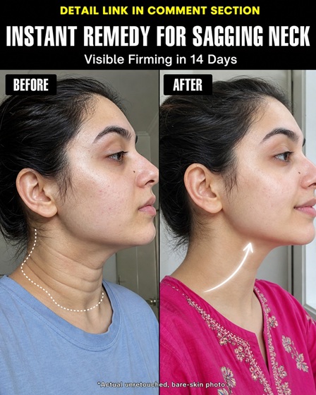 Instant Remedy for Sagging Neck – Visible Firming in 14 Days Naturally