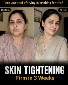Skin Tightening Naturally: Firm and Youthful Skin in 3 Weeks