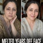 Melted Years Off Face in 8 Weeks Natural Remedies for Firmer, Younger-Looking Skin