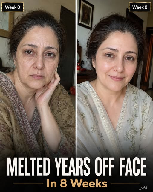 Melted Years Off Face in 8 Weeks Natural Remedies for Firmer, Younger-Looking Skin
