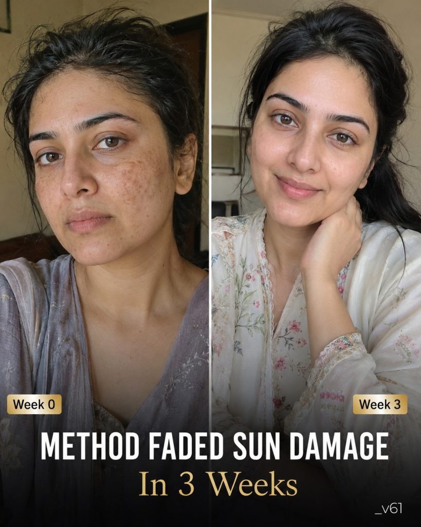 Method Faded Sun Damage In 3 Weeks Naturally