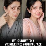 My Journey to a Wrinkle Free Youthful Face in 6 Weeks