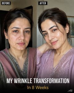 My Wrinkle Transformation Naturally Smooth and Youthful Skin in 8 Weeks