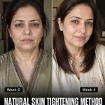 NATURAL SKIN TIGHTENING METHOD IN 4 WEEKS