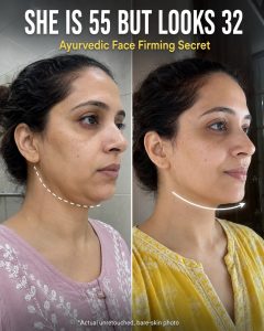 She Is 55 But Looks 32 – Ayurvedic Face Firming Secret