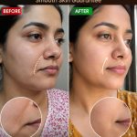 Tighten Sagging Mouth Area Naturally – Smooth Skin Home Remedies