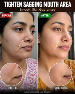 Tighten Sagging Mouth Area Naturally – Smooth Skin Home Remedies