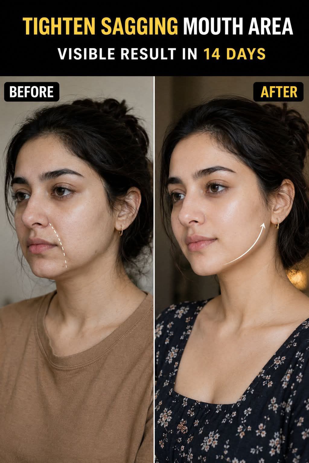 Tighten Sagging Mouth Area Naturally – Visible Results in 14 Days