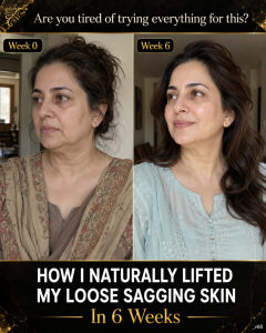 Naturally Tighten Loose Sagging Skin in 6 Weeks with Scientifically-Supported Home Remedies