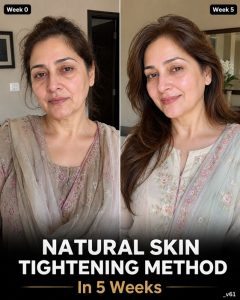 Natural Skin Tightening Method in 5 Weeks