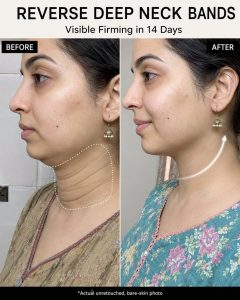 Reverse Deep Neck Bands Naturally: Ancient Firming Remedies for a Smoother Neck in 14 Days