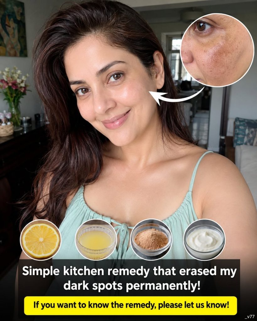 Simple Kitchen Remedy That Helped Fade Dark Spots Naturally
