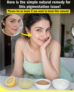 Remove Pigmentation Naturally at Home: Simple Lemon, Yogurt, and Licorice Face Masks for Every Skin Type
