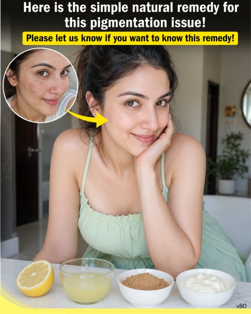 Remove Pigmentation Naturally at Home: Simple Lemon, Yogurt, and Licorice Face Masks for Every Skin Type