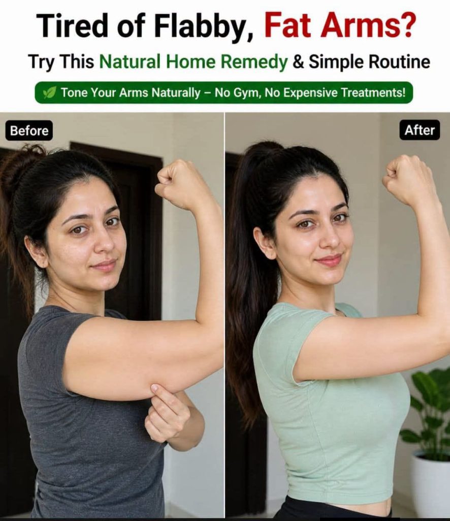 Get Rid of Flabby Arms Naturally: 3 Proven Home Remedies, Diet Plan and Exercise Routine