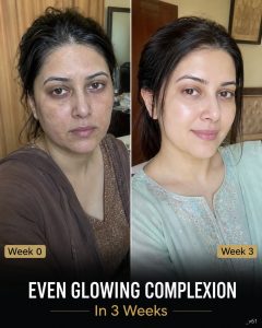 Get an Even Glowing Complexion Naturally in 3 Weeks Scientifically Supported Home Remedies for Every Skin Type
