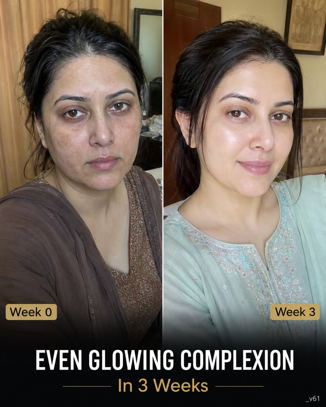 Get an Even Glowing Complexion Naturally in 3 Weeks: Scientifically Supported Home Remedies for Every Skin Type