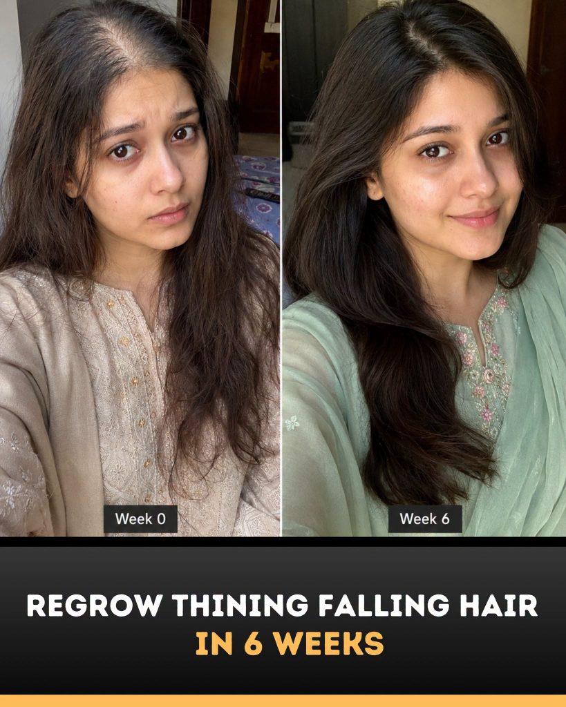 Regrow Thinning and Falling Hair Naturally in 6 Weeks Science-Backed Home Remedies