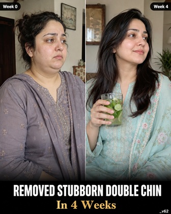 Remove a Stubborn Double Chin Naturally in 4 Weeks Evidence-Based Home Remedies, Diet Plan, and Exercises