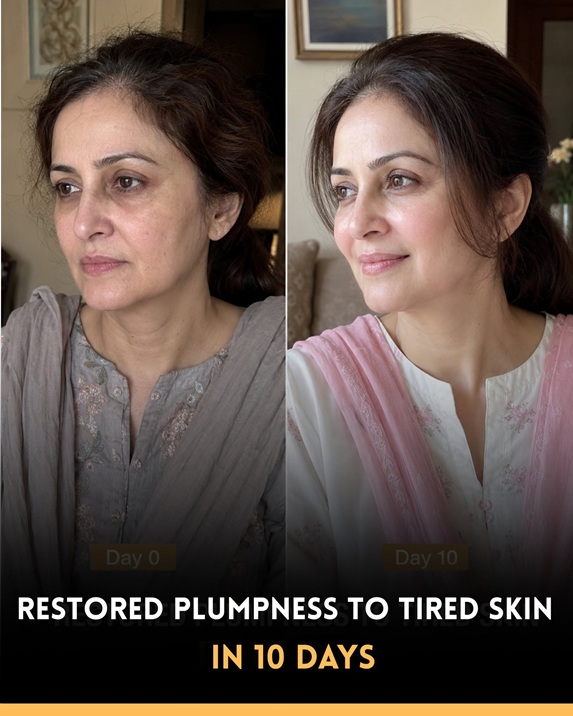 Restore Plumpness to Tired Skin Naturally in 10 Days: Scientifically Supported Home Remedies for Every Skin Type