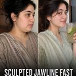 Reverse Deep Neck Bands Naturally in 14 Days