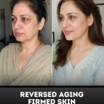 Reversed Aging and Firmer-Looking Skin Naturally A 5-Week Home Care Plan for Every Skin Type
