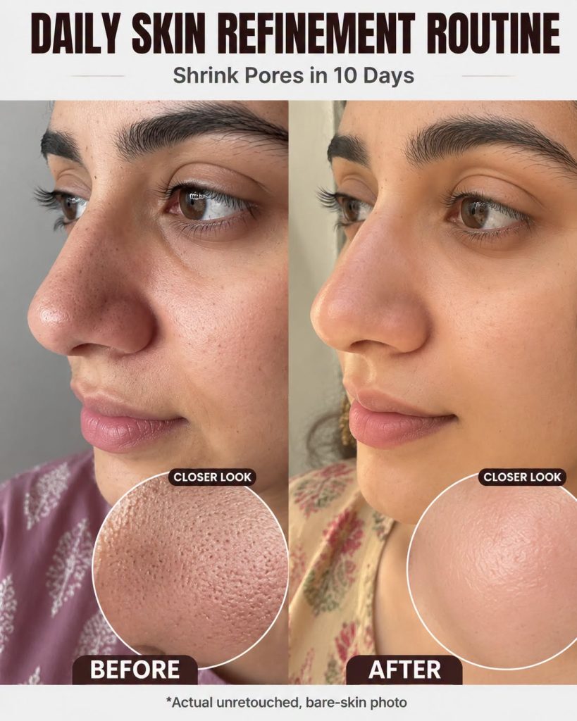 Daily Skin Refinement Routine: Reduce the Appearance of Large Pores Naturally