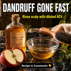 Dandruff Gone Fast: Diluted ACV Scalp Rinse and Natural Remedies by Scalp Type